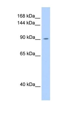 OSMR beta Antibody, Novus Biologicals 100&mu;L; Unlabeled:Antibodies, Polyclonal