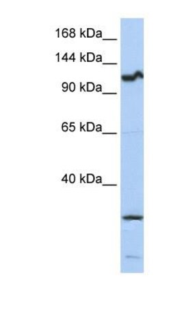 OSMR beta Antibody, Novus Biologicals 0.05mg; Unlabeled:Antibodies, Polyclonal