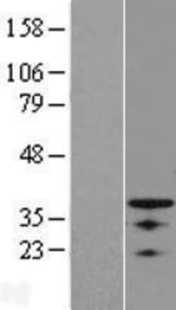 Novus Biologicals&trade;&nbsp;OSR1 Overexpression Lysate