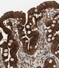 OSTB Antibody, Novus Biologicals 0.1 mL | Buy Online | Novus Biologicals | Fisher Scientific