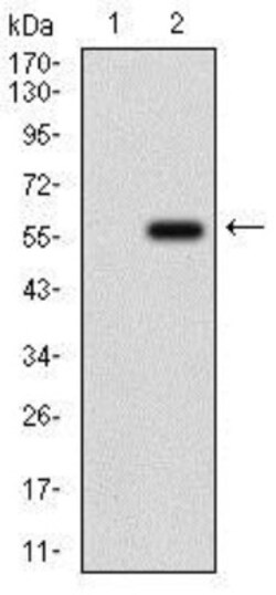 Osteoactivin/GPNMB Antibody (7C10E5) - BSA Free, Novus Biologicals:Antibodies:Primary