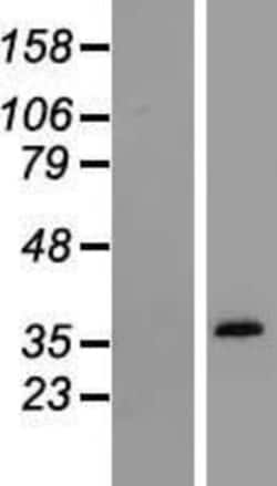 Novus Biologicals Osteopontin/OPN Overexpression Lysate 0.1 mg | Buy Online | Novus Biologicals&trade; | Fisher Scientific