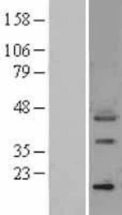 Novus Biologicals&trade;&nbsp;Osteopontin/OPN Overexpression Lysate