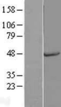 Novus Biologicals&trade;&nbsp;Osteopontin/OPN Overexpression Lysate