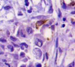 Osteopontin/OPN Antibody (1B20) - BSA Free, Novus Biologicals:Antibodies:Primary