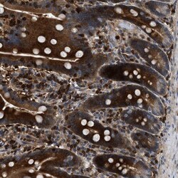 OSTF1 Antibody, Novus Biologicals:Antibodies:Primary Antibodies