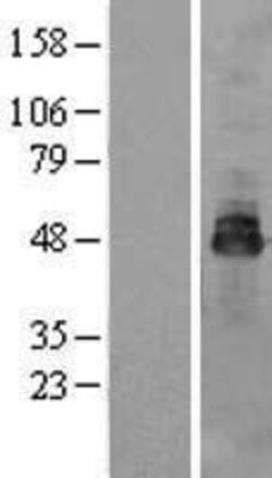 Novus Biologicals&trade;&nbsp;OSTM1 Overexpression Lysate