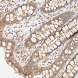 OTOP2 Antibody, Novus Biologicals 0.1mL; Unlabeled:Antibodies, Polyclonal