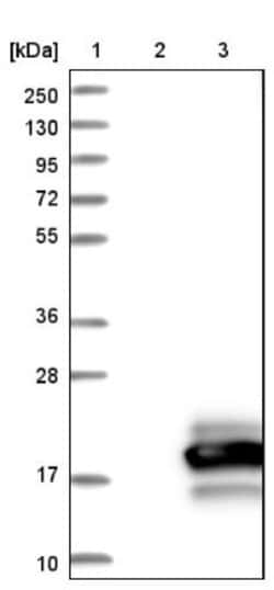 Otoraplin/OTOR Antibody, Novus Biologicals:Antibodies:Primary Antibodies