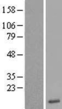 Novus Biologicals™ Otoraplin/OTOR Overexpression Lysate