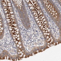 Otoraplin/OTOR Antibody, Novus Biologicals:Antibodies:Primary Antibodies