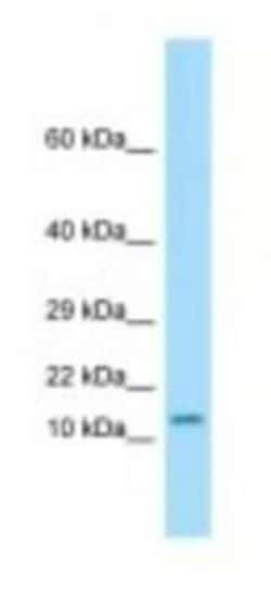 OTOS Antibody, Novus Biologicals:Antibodies:Primary Antibodies