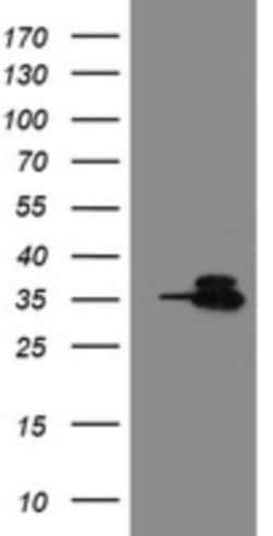 Otubain-1 Antibody (OTI5B8), Novus Biologicals 0.1 mL | Buy Online | Novus Biologicals | Fisher Scientific