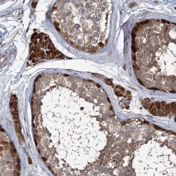 Otubain-1 Antibody, Novus Biologicals:Antibodies:Primary Antibodies