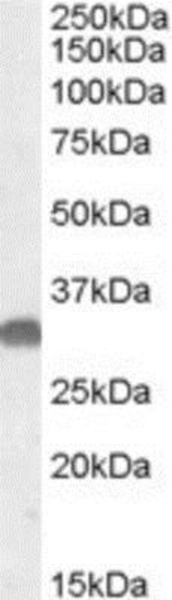 Otubain-1 Antibody, Novus Biologicals 0.1mg; Unlabeled:Antibodies, Polyclonal