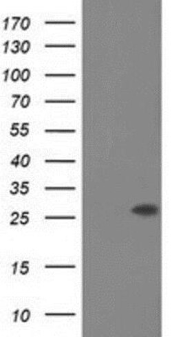 Otubain-2 Antibody (OTI11B3), Novus Biologicals 0.1mL; Unlabeled:Antibodies,