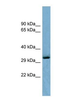 OTUD6B Antibody, Novus Biologicals 100 &mu;L | Buy Online | Novus Biologicals | Fisher Scientific