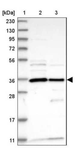 OTUD6B Antibody, Novus Biologicals 25 &mu;L | Buy Online | Novus Biologicals | Fisher Scientific