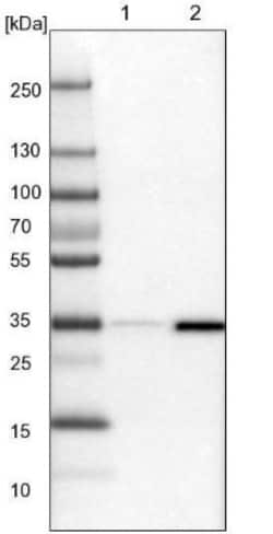 OTUD6B Antibody, Novus Biologicals 0.1mL; Unlabeled:Antibodies, Polyclonal