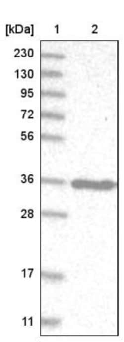 OTUD6B Antibody, Novus Biologicals 0.1mL; Unlabeled:Antibodies, Polyclonal