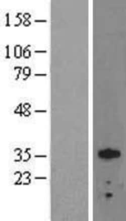 Novus Biologicals™ Otx2 Overexpression Lysate