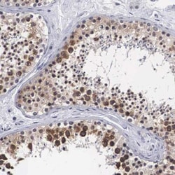 Otx2 Antibody, Novus Biologicals:Antibodies:Primary Antibodies