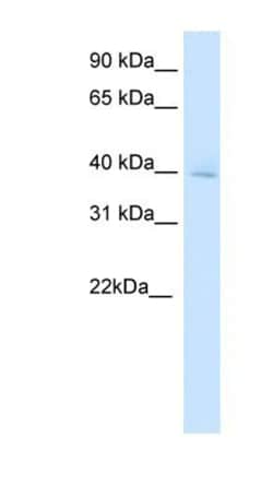OTX3 Antibody, Novus Biologicals 20μL; Unlabeled:Antibodies, Polyclonal
