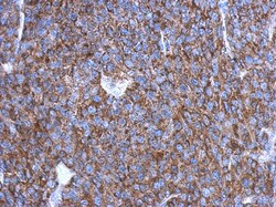 OVCA2 Antibody, Novus Biologicals 0.1mL; Unlabeled:Antibodies, Polyclonal