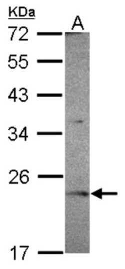 OVCA2 Antibody, Novus Biologicals 0.1mL; Unlabeled:Antibodies, Polyclonal