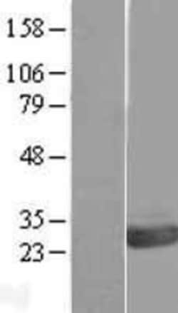 Novus Biologicals&trade;&nbsp;OVCA2 Overexpression Lysate