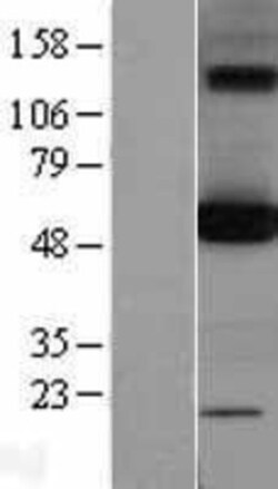 Novus Biologicals™ OXCT1 Overexpression Lysate