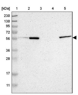 OXCT1 Antibody, Novus Biologicals 0.1 mL | Buy Online | Novus Biologicals | Fisher Scientific