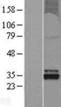 Novus Biologicals&trade;&nbsp;OXNAD1 Overexpression Lysate