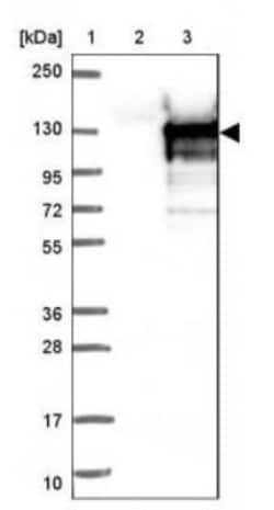 Cytochrome P450 2C9 Antibody, Novus Biologicals:Antibodies:Primary Antibodies