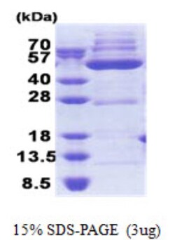 Novus Biologicals&trade;&nbsp;Recombinant Human OXSM His Protein