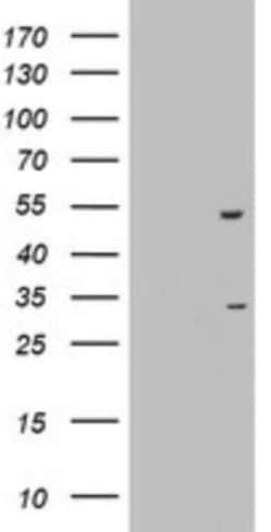 OXSM Antibody (OTI4E10), Novus Biologicals 0.1mL; Unlabeled:Antibodies,