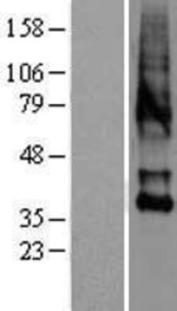 Novus Biologicals™ OXTR Overexpression Lysate