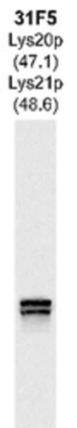 Lys20p and Lys21p Antibody (31F5), Novus Biologicals 0.125 mL; Unconjugated:Antibodies,