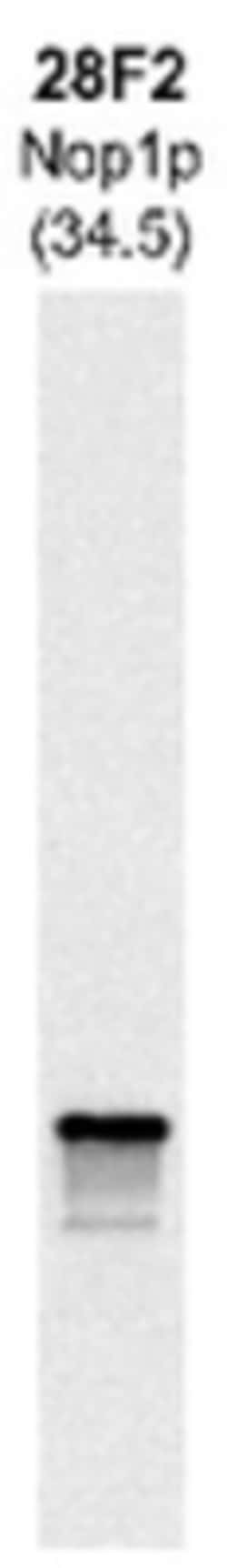 Fibrillarin Antibody (28F2), Novus Biologicals 0.5 mL; Unconjugated:Antibodies,