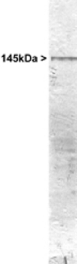 NF-M Antibody, Novus Biologicals 0.1mL; Unlabeled:Antibodies, Polyclonal