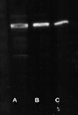 Parkin Antibody, Novus Biologicals 0.05mL; Unlabeled:Antibodies, Polyclonal