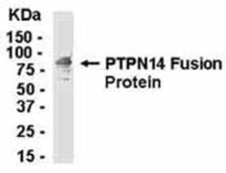 PTPN14/PTPD2 Antibody 0.05mg; Unlabeled:Antibodies, Polyclonal