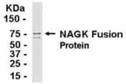 anti-N-Acetyl-D-Glucosamine Kinase/NAGK, Polyclonal, Novus Biologicals