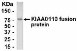 MAD2L1-binding protein Antibody 0.05 mg | Buy Online | Novus Biologicals | Fisher Scientific