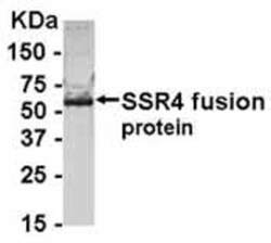 Signal sequence receptor delta Antibody 0.05mg; Unlabeled:Antibodies, Polyclonal