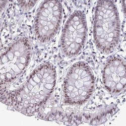 p107 Antibody, Novus Biologicals 0.1mL; Unlabeled:Antibodies, Polyclonal