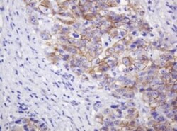 p120-catenin Antibody (OTI2E8), Novus Biologicals 0.1mL; Unlabeled:Antibodies,