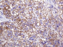 p120-catenin Antibody (OTI2E8), Novus Biologicals 0.1mL; Unlabeled:Antibodies,