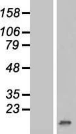 Novus Biologicals&trade;&nbsp;p15INK4b/CDKN2B Overexpression Lysate