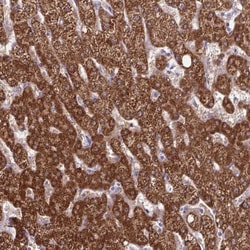 p15INK4b/CDKN2B Antibody, Novus Biologicals:Antibodies:Primary Antibodies